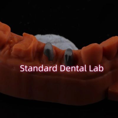 التاج المعدني بعد النواة CAD CAM البورسلين / الزركونيا التعامل مع تاج الزركونيا الكامل
