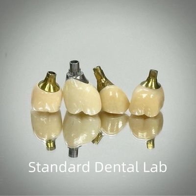 المهنية الزركونيا المسمار الاحتفاظ الزرع تاج التيتانيوم CAD CAM