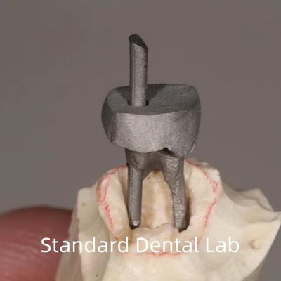 استعادة الأسنان القطب المعدني و التاج الأساسي مناسب تماماً