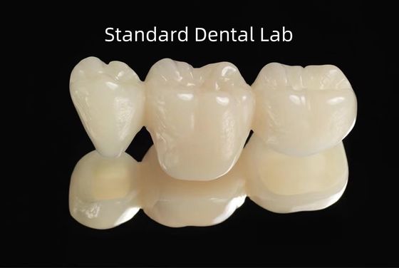 CAD CAM PMMA الفارغ الجسر الأسناني المؤقت المؤقت
