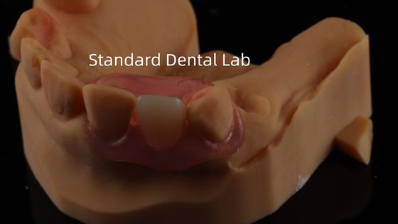 أسنان TCS Valplast مرنة الأسنان الجزئية Nesbit Valplast النهاية الصين مختبر الأسنان Valplast مقفل