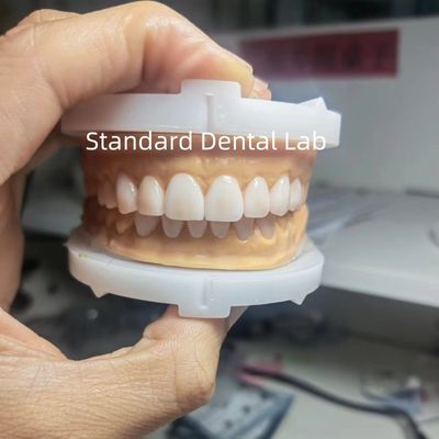 التجميل المثالي الشمع المؤقت للأخصائيين في طب الأسنان باستخدام الشمع الأسنان من الصين مختبر الأسنان