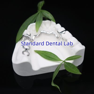 الفيتاليم 2000 الإطار الجزئي ISO CE و FDA الصين المختبر الأسنان الإطار المعدني