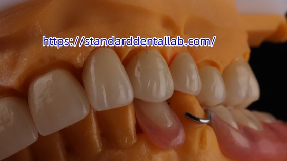 تاج الأسنان الزركونية المتعددة الطبقات والجسر الشفافية 3D PRO تاج زركونيا البورسلين المختبر الأسنان القياسية