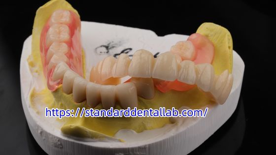 جمالية عالية الأسنان TCS Valplast مرنة الأسنان الجزئية العدد الأسنان المختبر Valplast العقدة الوردي