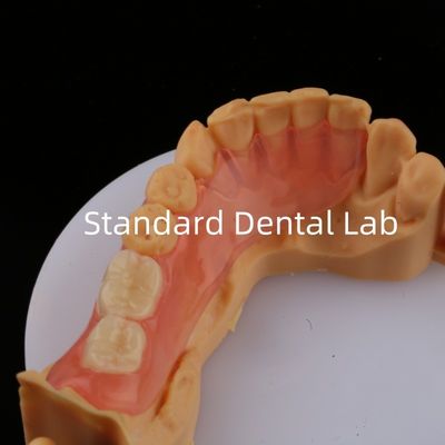 الأسنان الزهرية / الداكنة TCS Valplast الأسنان الجزئية المرنة للاستراتيجية العالية نموذج طباعة 3D للأسنان
