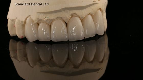 تاج الزركونيا الكامل و جسر أسنان طبيعي عالي الجمال 5 سنوات ضمان