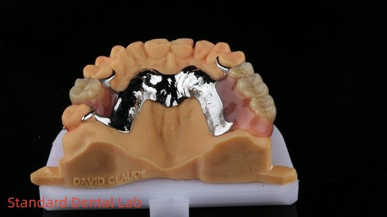 CorCr المعدن جزء من الأسنان العضلية الضوء العالي بيريليوم الحر Ivoclar Scheftner الإطار المعدني المريح