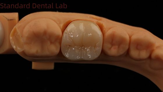 طباعة أسنان رقمية كاملة من الزركونيا مع نوريتاكي البورسلين 3D الطباعة نموذج 5 سنوات ضمان