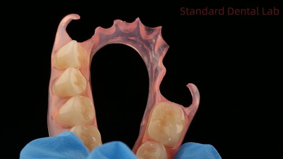 طب الأسنان TCS Valplast الأسنان الجزئية المرنة مختبر الأسنان الطابعة ثلاثية الأبعاد نموذج جمالية عالية