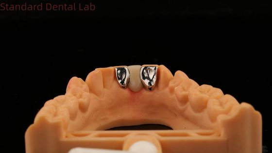 طب الأسنان (بي.إف.إم) (ميرلاند بريدج) جمالية عالية معتمدة من قبل إدارة الأغذية والعقاقير (فيتا بورسليان) مختبر أسنان الصين