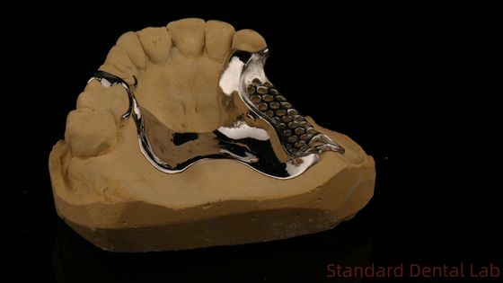 قوة عالية 3D طباعة إطار صب COCR أطقم الأسنان الجزئية الكروم الكوبالت إطار معدني صب