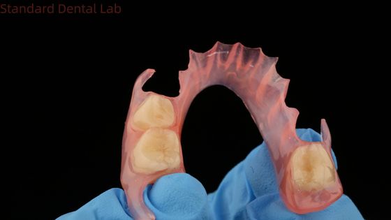 طابعة ثلاثية الأبعاد نموذج الأسنان TCS Valplast أسنان جزئية مرنة اللون الوردي / الداكن منتج مختبر الأسنان