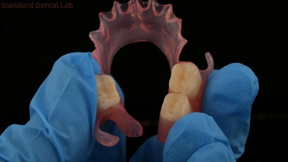 أسنان TCS Valplast مرنة الأسنان الجزئية Nesbit Valplast النهاية الصين مختبر الأسنان Valplast مقفل