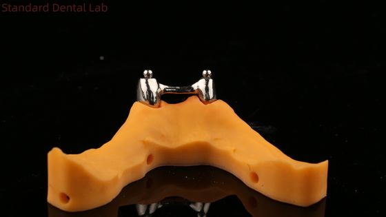 (إيفوكلار) طبقة أسنان رقميّة مع أسنانٍ معدّلة