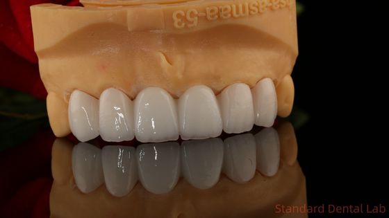 السترة الزركونية الشفافة 3D PRO بدون طبقة البورسلين
