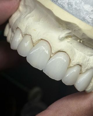 الاسم