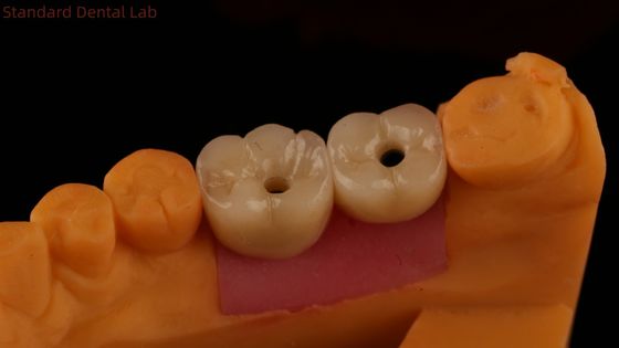 الاسم