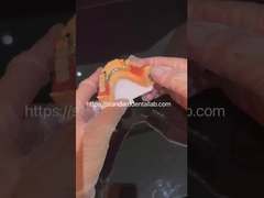 صياغة الأسنان الجزئية الأكريلية ذات الجمال العالي مع عقدة واضحة وأسنان أكريلية