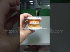 بروكز زير ذات الشكل الكامل التاج الزركونيا الجسر