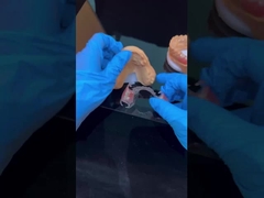 الإطار الواضح الأكريليك المعدني إطارات الأسنان الجزئية الجمالية العالية المختبر الصيني للأسنان