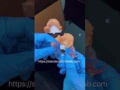 FDA الكوبالت الكروم عالية الجمالية واضحة الإطار الجزئي