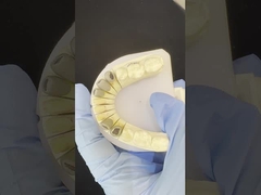 المعدن الصب الصندوق القلب التاج كوكر دقيق الاحتفاظ بالكامل الزركونيا بروكسير