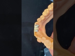 أسنان أسنان PFM جسر ماريلاند جمالية عالية معتمدة من قبل FDA