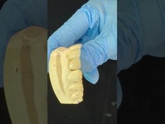 تاج الزركونيا الكامل / جمالي عالي طبيعي مخصص مساعد زركونيا جسر أسنان