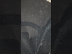 أطقم أسنان مدعومة بالزرع من التيتانيوم أطقم أسنان دقيقة فوق الزرع