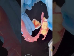 نموذج الطباعة ثلاثية الأبعاد جمالية عالية الأسنان TCS Valplast مرنة أسنان جزئية مختبر الأسنان